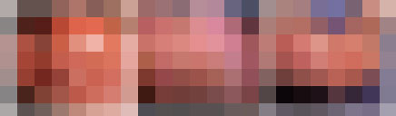 尖锐湿疣早期症状有哪些