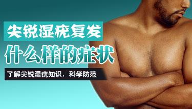 尖锐湿疣为何容易复发