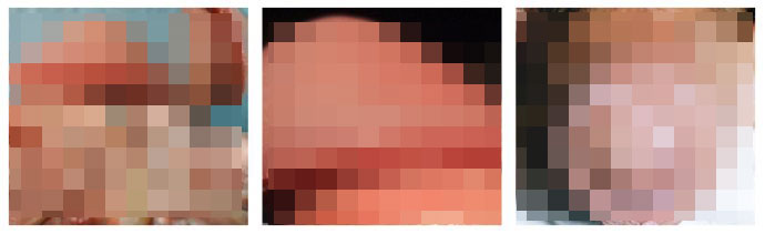 河池尖锐湿疣的危害 河池尖锐湿疣的危害