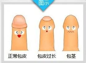 包皮包茎怎么判断？
