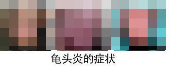 男性包皮龟头炎会传染吗?