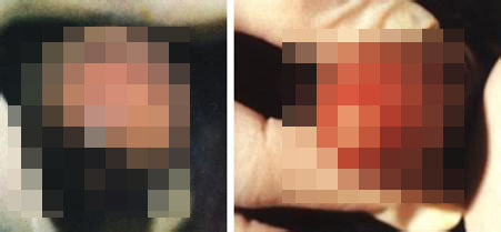 河池引起男性非淋的原因是什么 河池引起男性非淋的原因是什么