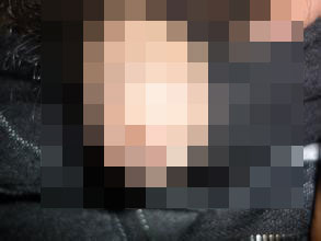 河池如何让淋病不在复发 河池如何让淋病不在复发