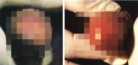 男性非淋是什么样的 男性非淋是什么样的