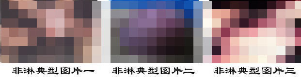 非淋的症状有哪些? 非淋的症状有哪些?