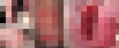 生殖器疱疹的症状什么样 生殖器疱疹的症状什么样