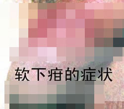 软下疳会引发阳痿吗? 软下疳会引发阳痿吗?